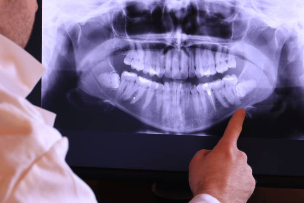 Best Emergency Dentist for Special Needs Patients in Percy, IL