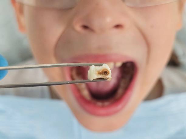Best Orthodontic Emergency Dentist in Percy, IL